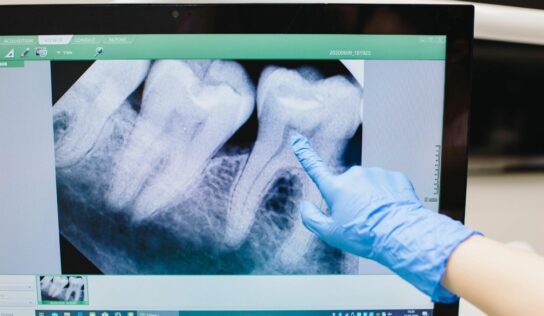 «Cada vez hay más evidencia de que la enfermedad periodontal, una inflamación crónica de las encías, puede estar relacionada con un mayor riesgo de sufrir infartos o accidentes cardiovasculares», doctor Carlos Mederos