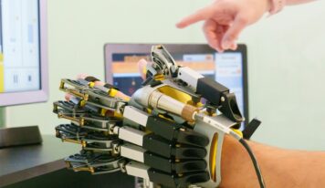 «La neurorrehabilitación permite, en momentos concretos de la enfermedad del Parkinson, mejorar limitaciones motoras, de coordinación o dolor, lo que se traduce en meses o años de vida con mayor calidad», Dr. Alejandro Durán