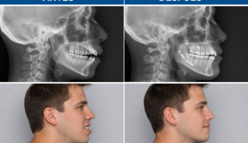 Dr. Tim Liesenhoff, cirujano maxilofacial: «Hoy los pacientes son más conscientes de la importancia de tener una mordida correcta»