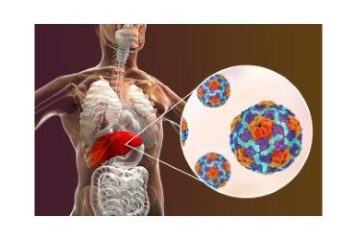 <div>Dr. Juan Arenas, jefe del servicio del Aparato Digestivo de Policlínica Gipuzkoa: «La hepatitis puede pasar desapercibida durante años: una simple prueba permite detectarla a tiempo»</div>
