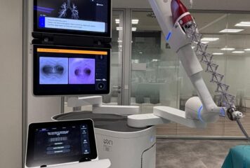 Fundación Jiménez Díaz incorpora el primer broncoscopio robótico de Madrid para mejorar el diagnóstico precoz del cáncer de pulmón
