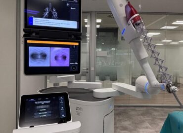 Fundación Jiménez Díaz incorpora el primer broncoscopio robótico de Madrid para mejorar el diagnóstico precoz del cáncer de pulmón